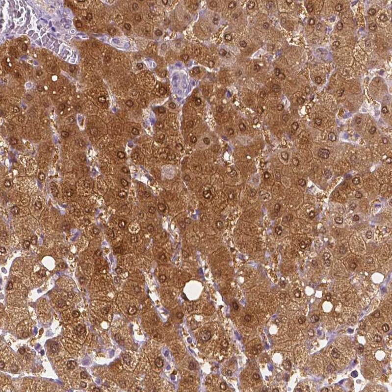 DAK Antibody - BSA Free Immunohistochemistry-Paraffin: DAK Antibody - BSA Free [NBP1-84142]