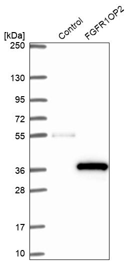 FGFR1OP2 Antibody - BSA Free Western Blot: FGFR1OP2 Antibody - BSA Free [NBP1-84148]
