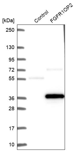 FGFR1OP2 Antibody - BSA Free Western Blot: FGFR1OP2 Antibody - BSA Free [NBP1-84149]