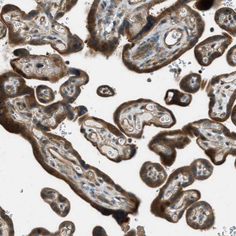 PTPN23 Antibody - BSA Free Immunohistochemistry-Paraffin: PTPN23 Antibody - BSA Free [NBP1-84158]
