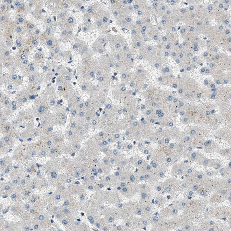 PTPN23 Antibody - BSA Free Immunohistochemistry-Paraffin: PTPN23 Antibody - BSA Free [NBP1-84158]