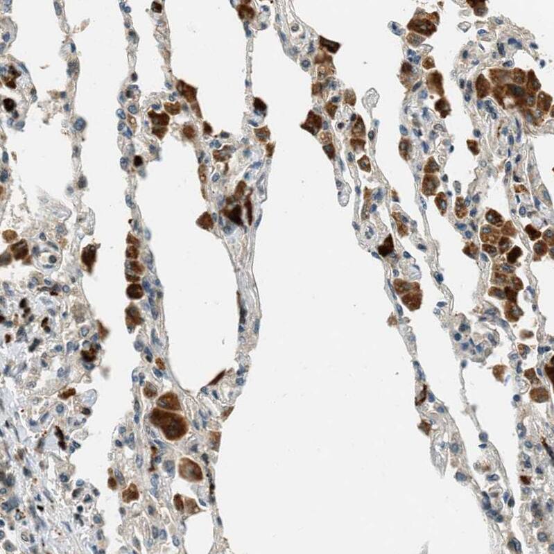 PTPN23 Antibody - BSA Free Immunohistochemistry-Paraffin: PTPN23 Antibody - BSA Free [NBP1-84158]