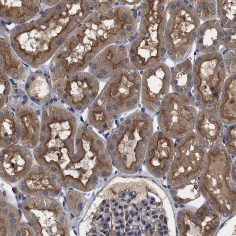 ARHGAP24 Antibody - BSA Free Immunohistochemistry-Paraffin: ARHGAP24 Antibody - BSA Free [NBP1-84161]