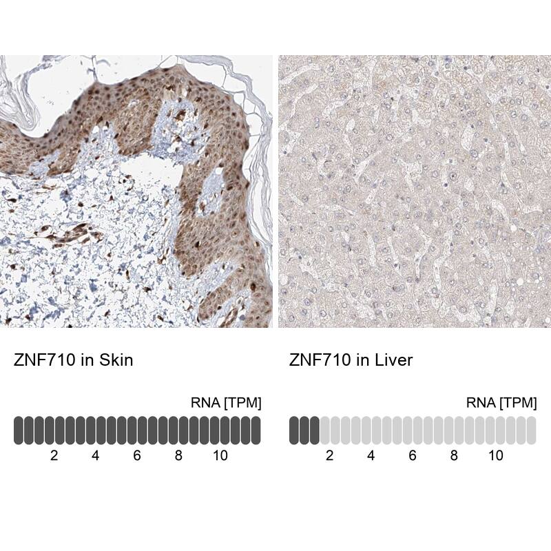 ZNF710 Antibody - BSA Free Immunohistochemistry-Paraffin: ZNF710 Antibody [NBP1-84166]