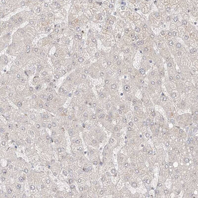 ZNF710 Antibody - BSA Free Immunohistochemistry-Paraffin: ZNF710 Antibody [NBP1-84166]