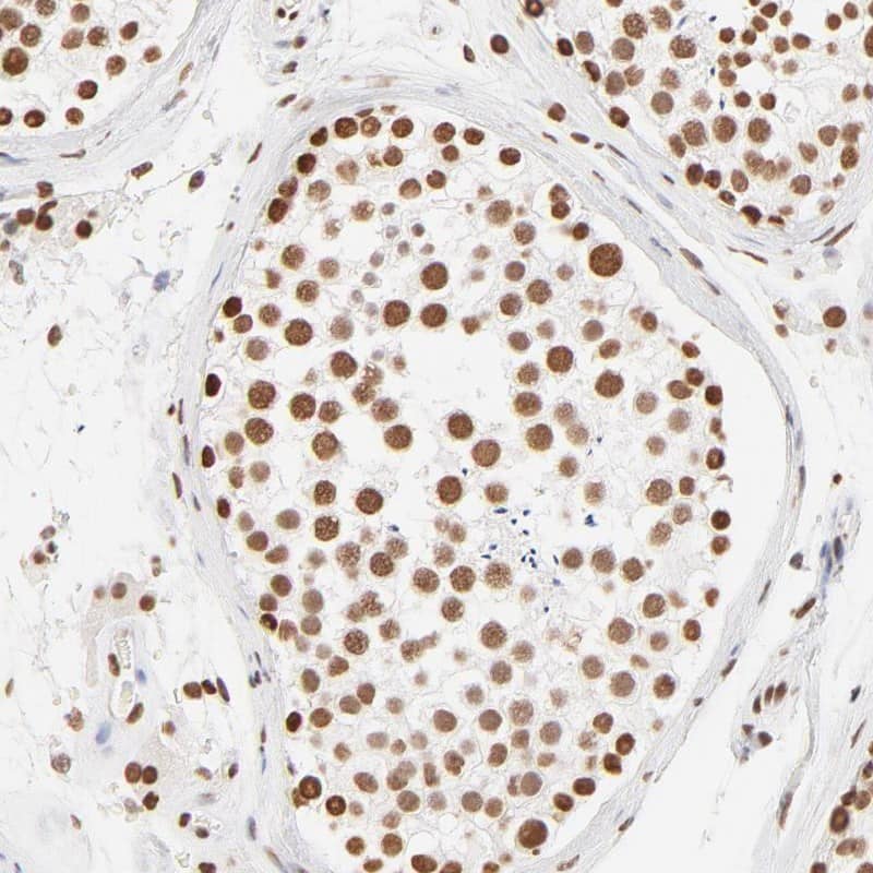 ZNF540 Antibody - BSA Free Immunohistochemistry-Paraffin: ZNF540 Antibody [NBP1-84170]