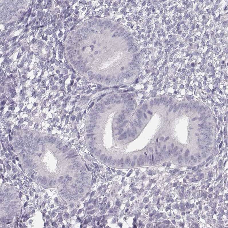 NUT Antibody - BSA Free Immunohistochemistry-Paraffin: NUT Antibody [NBP1-84176]
