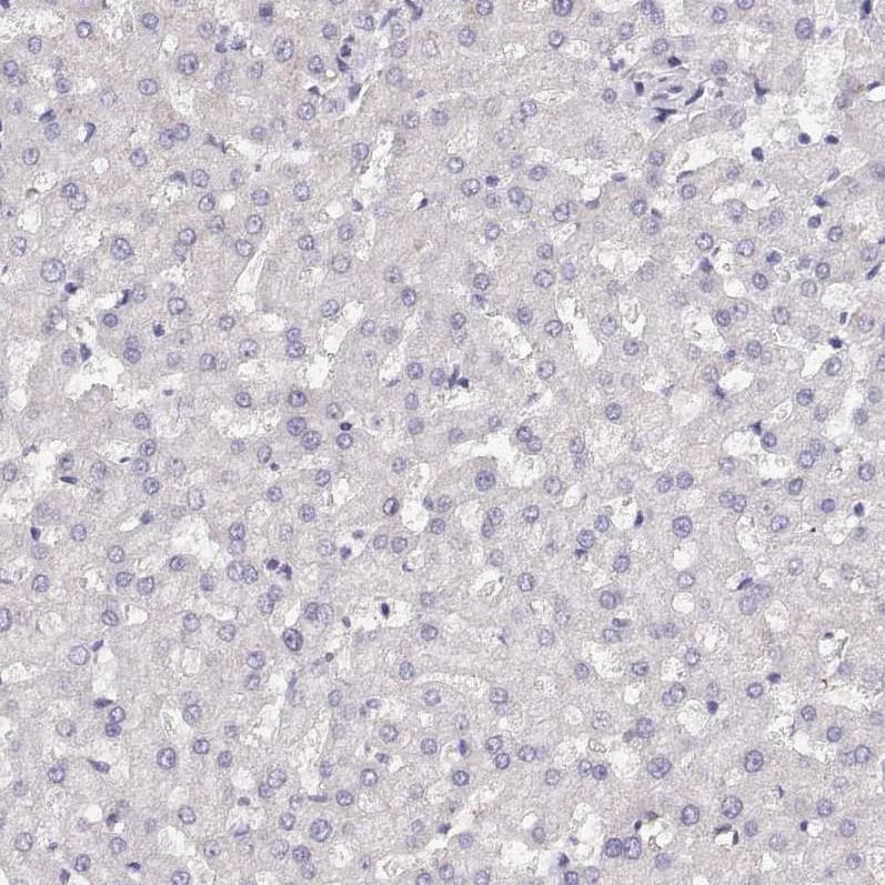 NUT Antibody - BSA Free Immunohistochemistry-Paraffin: NUT Antibody [NBP1-84176]
