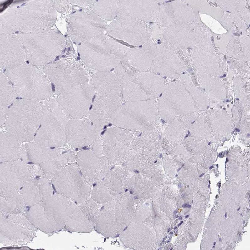 NUT Antibody - BSA Free Immunohistochemistry-Paraffin: NUT Antibody [NBP1-84176]