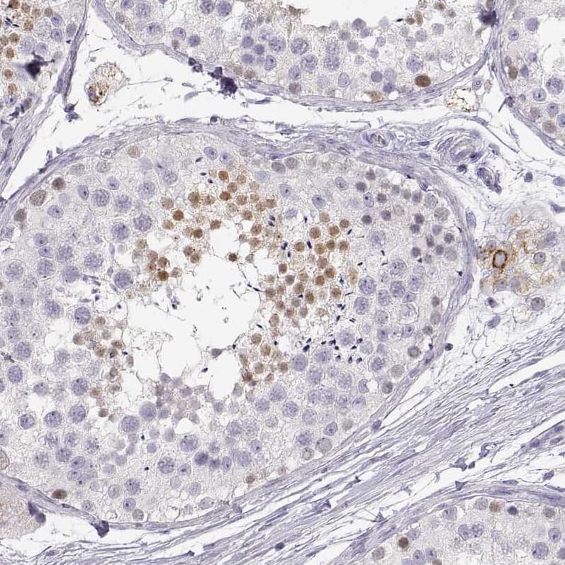 NUT Antibody - BSA Free Immunohistochemistry-Paraffin: NUT Antibody [NBP1-84176]