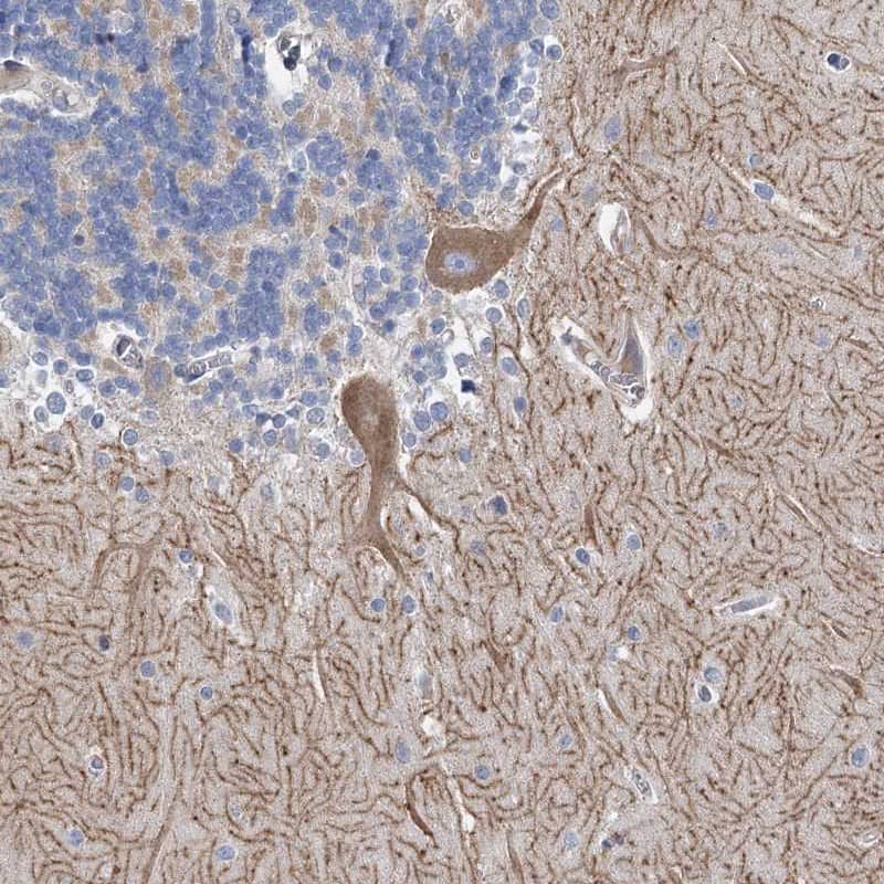 ANKRD16 Antibody - BSA Free Immunohistochemistry-Paraffin: ANKRD16 Antibody [NBP1-84178]