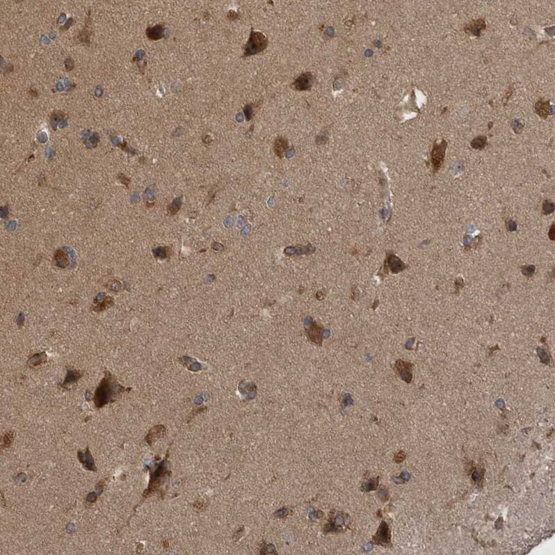 RAB3GAP2 Antibody - BSA Free Immunohistochemistry-Paraffin: RAB3GAP2 Antibody - BSA Free [NBP1-84198]
