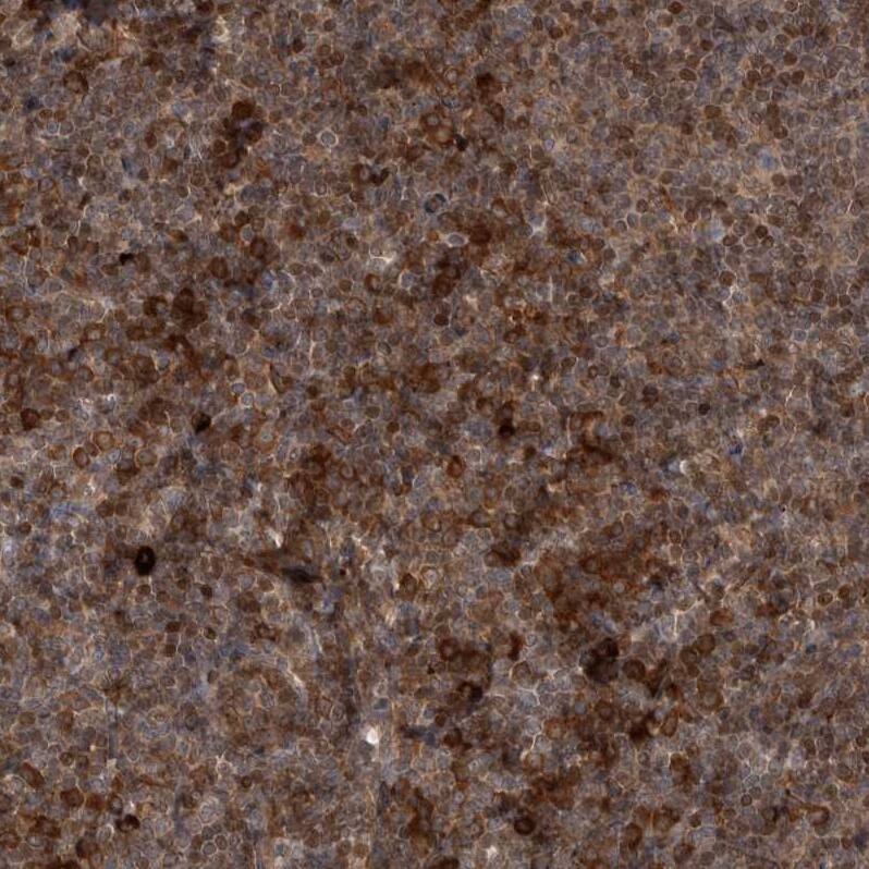 RAB3GAP2 Antibody - BSA Free Immunohistochemistry-Paraffin: RAB3GAP2 Antibody - BSA Free [NBP1-84198]