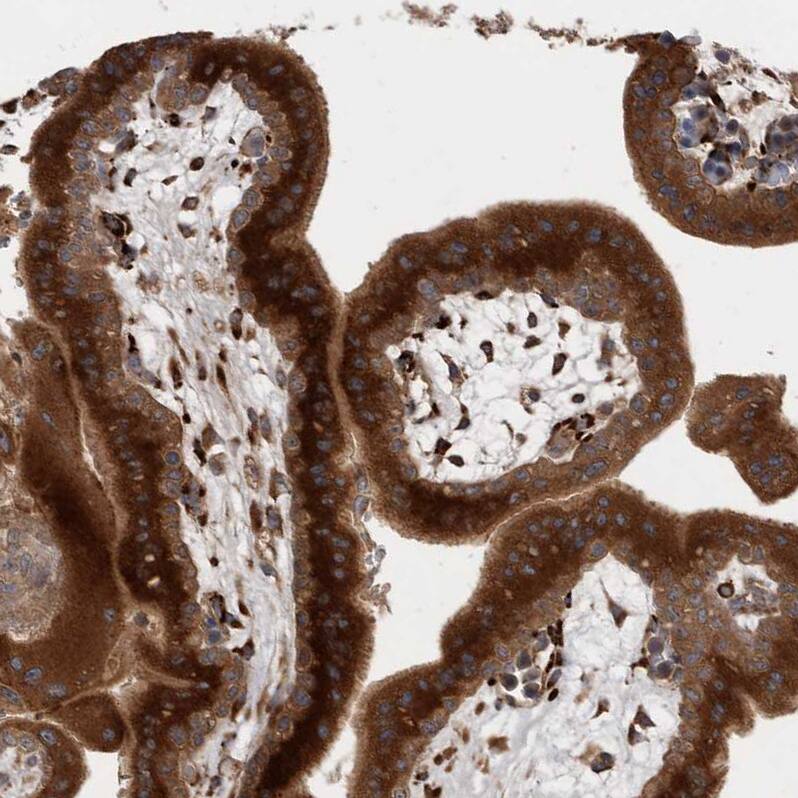 RAB3GAP2 Antibody - BSA Free Immunohistochemistry-Paraffin: RAB3GAP2 Antibody - BSA Free [NBP1-84198]