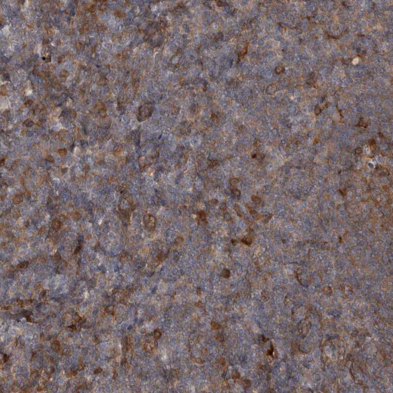 RAB3GAP2 Antibody - BSA Free Immunohistochemistry-Paraffin: RAB3GAP2 Antibody - BSA Free [NBP1-84199]
