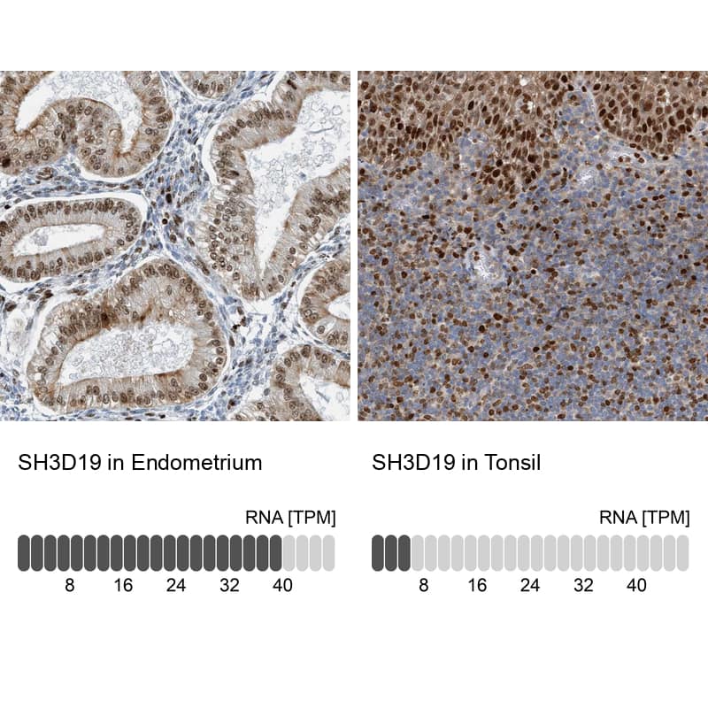 SH3D19 Antibody - BSA Free Immunohistochemistry-Paraffin: SH3D19 Antibody - BSA Free [NBP1-84203]
