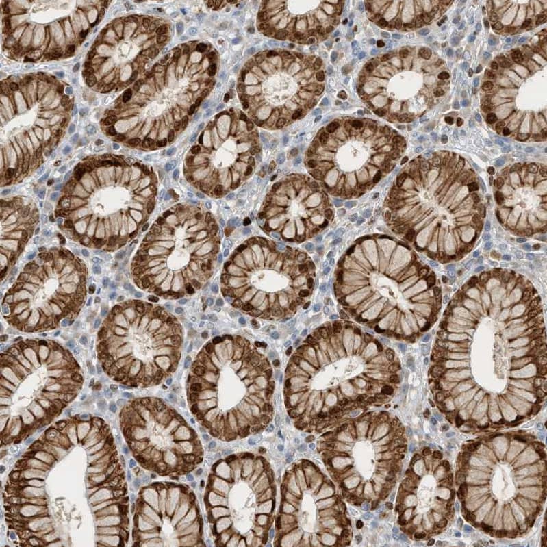 SH3D19 Antibody - BSA Free Immunohistochemistry-Paraffin: SH3D19 Antibody - BSA Free [NBP1-84203]