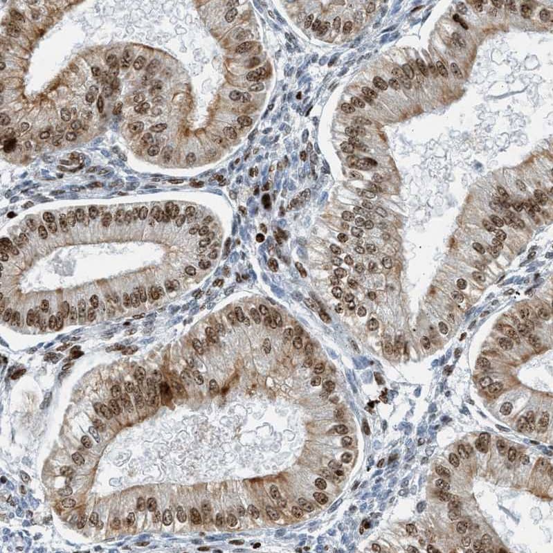 SH3D19 Antibody - BSA Free Immunohistochemistry-Paraffin: SH3D19 Antibody - BSA Free [NBP1-84203]