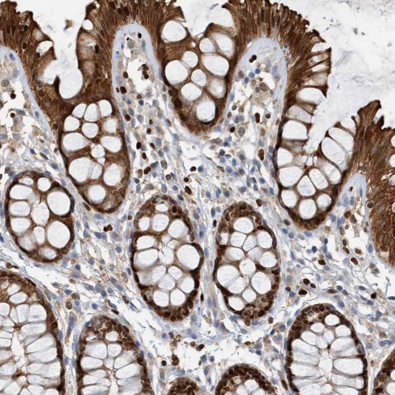 SH3D19 Antibody - BSA Free Immunohistochemistry-Paraffin: SH3D19 Antibody - BSA Free [NBP1-84203]