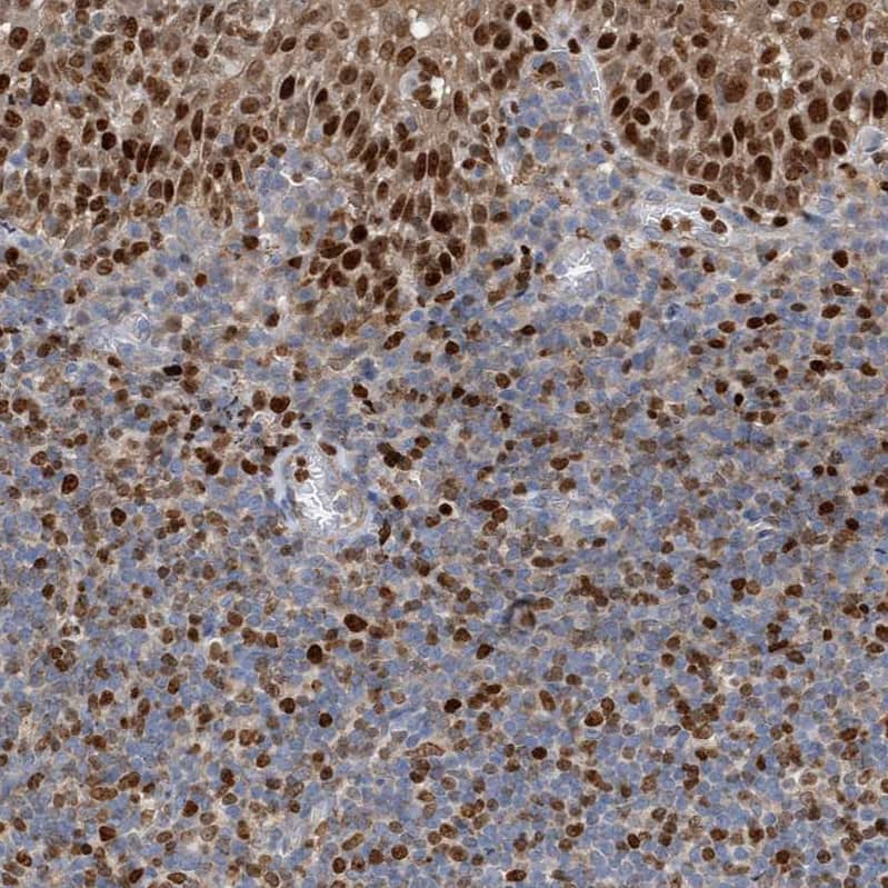 SH3D19 Antibody - BSA Free Immunohistochemistry-Paraffin: SH3D19 Antibody - BSA Free [NBP1-84203]
