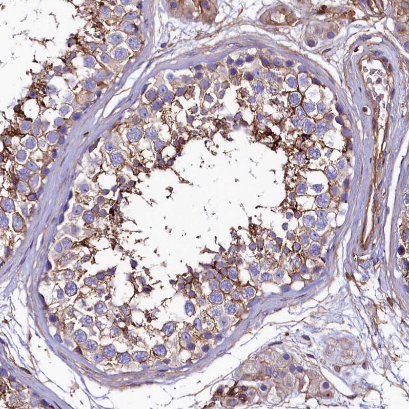 ANO6 Antibody - BSA Free Immunohistochemistry-Paraffin: ANO6 Antibody - BSA Free [NBP1-84207]