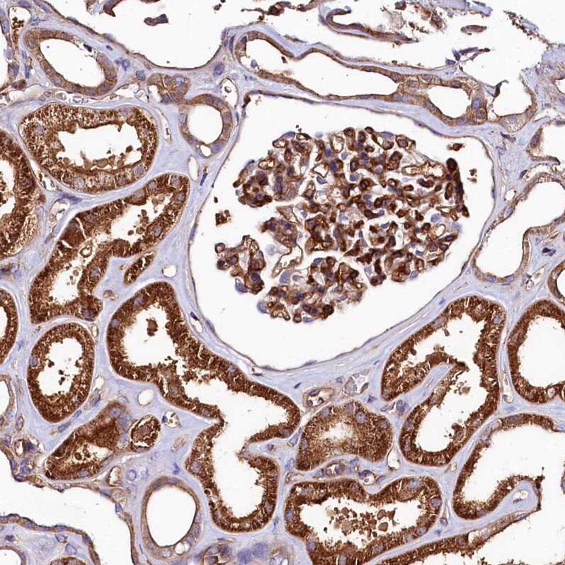 ANO6 Antibody - BSA Free Immunohistochemistry-Paraffin: ANO6 Antibody - BSA Free [NBP1-84207]