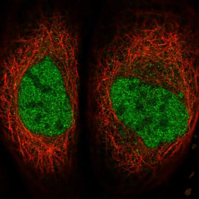 SERTAD4 Antibody - BSA Free Immunocytochemistry/ Immunofluorescence: SERTAD4 Antibody [NBP1-84216]