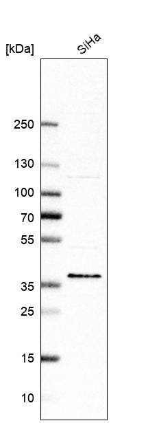C6orf106 Antibody - BSA Free Western Blot: C6orf106 Antibody - BSA Free [NBP1-84224]