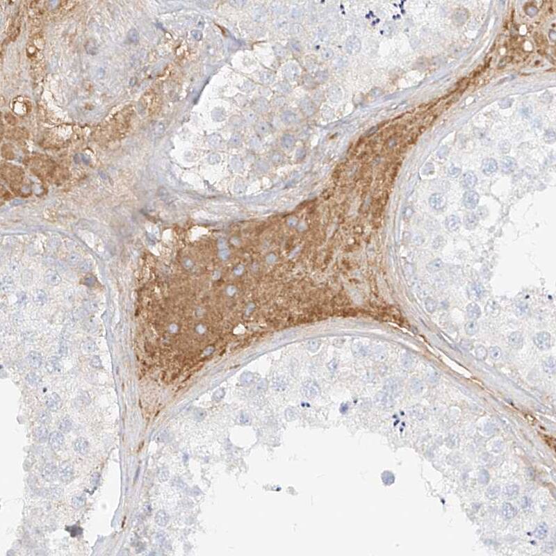 OC-STAMP Antibody - BSA Free Immunohistochemistry-Paraffin: OC-STAMP Antibody - BSA Free [NBP1-84230]