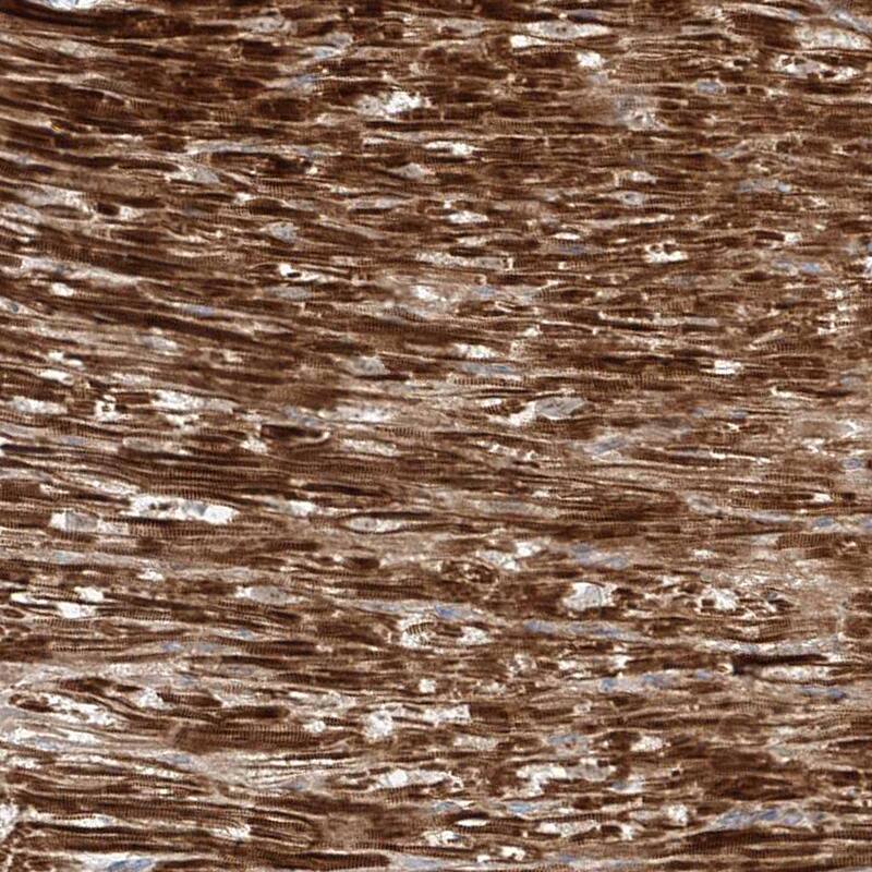 OC-STAMP Antibody - BSA Free Immunohistochemistry-Paraffin: OC-STAMP Antibody - BSA Free [NBP1-84230]