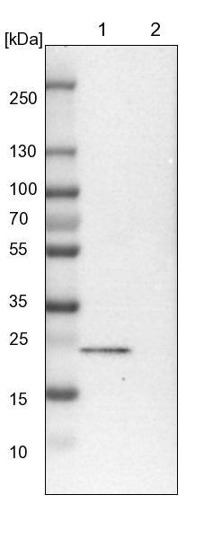 TBC1D7 Antibody - BSA Free Western Blot: TBC1D7 Antibody - BSA Free [NBP1-84231]