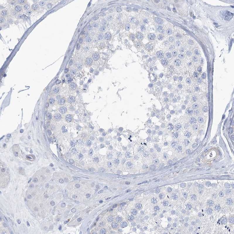 MOXD1 Antibody - BSA Free Immunohistochemistry-Paraffin: MOXD1 Antibody [NBP1-84233]