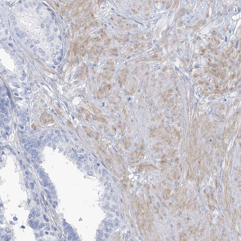 MOXD1 Antibody - BSA Free Immunohistochemistry-Paraffin: MOXD1 Antibody [NBP1-84233]