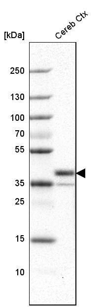 BAD-LAMP/LAMP5 Antibody - BSA Free Western Blot: BAD-LAMP/LAMP5 Antibody - BSA Free [NBP1-84246]
