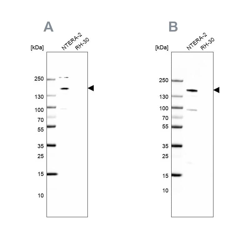 SALL4 Antibody - BSA Free Western Blot: SALL4 Antibody - BSA Free [NBP1-84247]