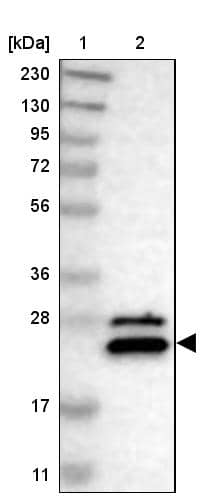 NUDT4 Antibody - BSA Free Western Blot: NUDT4 Antibody - BSA Free [NBP1-84250]