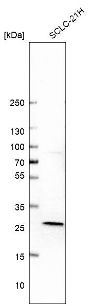 Deoxyguanosine kinase Antibody - BSA Free Western Blot: Deoxyguanosine kinase Antibody - BSA Free [NBP1-84256]