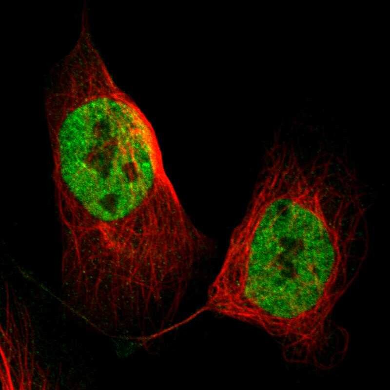 DGCR14 Antibody - BSA Free Immunocytochemistry/ Immunofluorescence: DGCR14 Antibody [NBP1-84258]
