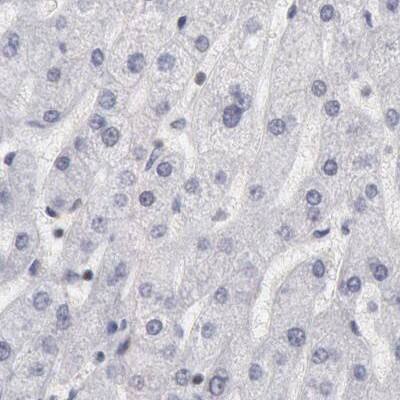 DGCR14 Antibody - BSA Free Immunohistochemistry-Paraffin: DGCR14 Antibody - BSA Free [NBP1-84258]