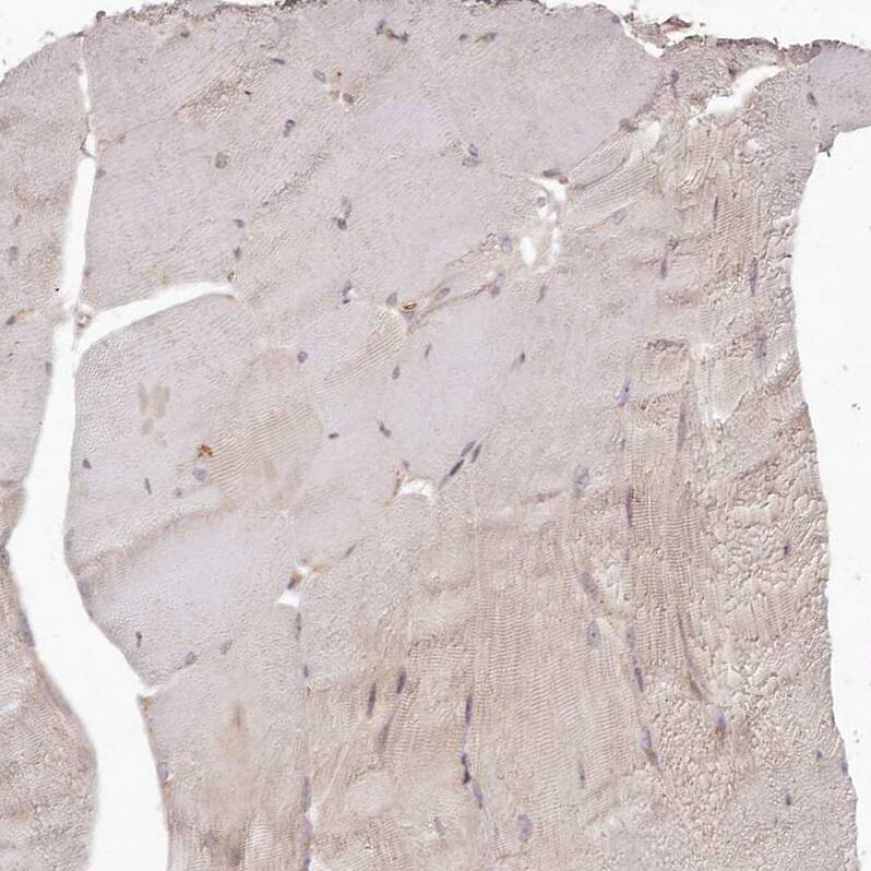 TMIE Antibody - BSA Free Immunohistochemistry-Paraffin: TMIE Antibody - BSA Free [NBP1-84260]