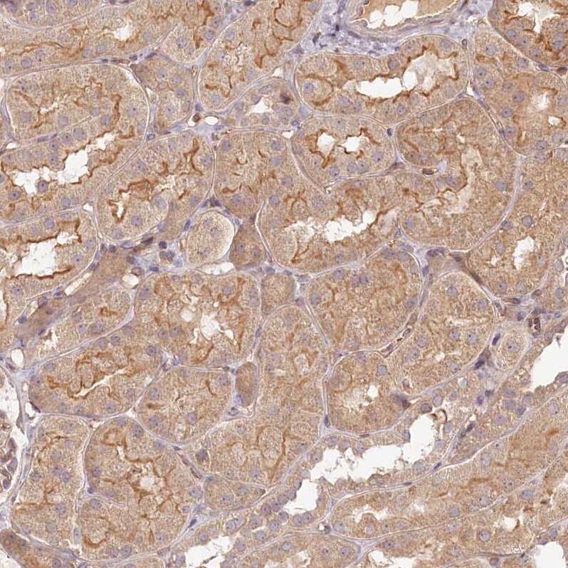TMIE Antibody - BSA Free Immunohistochemistry-Paraffin: TMIE Antibody - BSA Free [NBP1-84260]