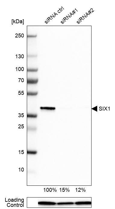 SIX1 Antibody - BSA Free Western Blot: SIX1 Antibody - BSA Free [NBP1-84264]