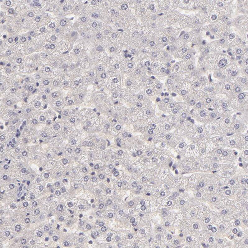 SIX1 Antibody - BSA Free Immunohistochemistry-Paraffin: SIX1 Antibody - BSA Free [NBP1-84264]
