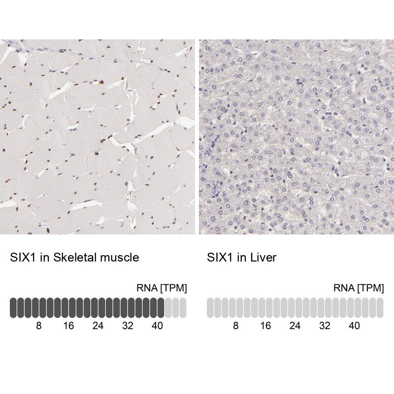 SIX1 Antibody - BSA Free Immunohistochemistry-Paraffin: SIX1 Antibody - BSA Free [NBP1-84264]