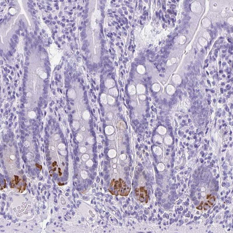 Defensin alpha 5 Antibody - BSA Free Immunohistochemistry-Paraffin: Defensin alpha 5 Antibody - BSA Free [NBP1-84282]