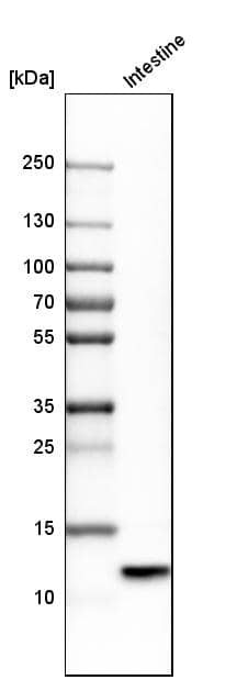 Defensin alpha 5 Antibody - BSA Free Western Blot: Defensin alpha 5 Antibody - BSA Free [NBP1-84282]