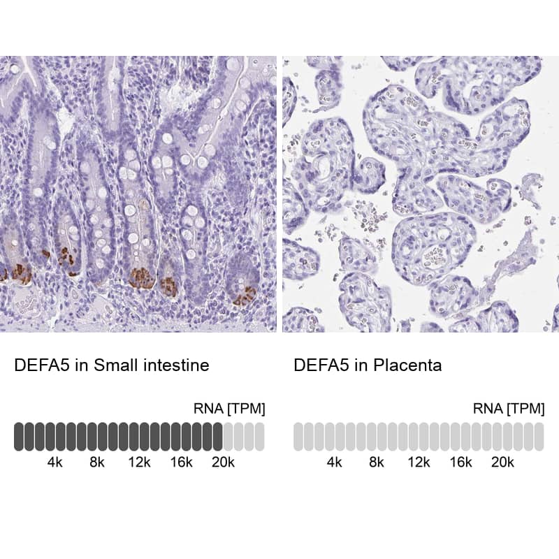 Defensin alpha 5 Antibody - BSA Free Immunohistochemistry-Paraffin: Defensin alpha 5 Antibody - BSA Free [NBP1-84282]