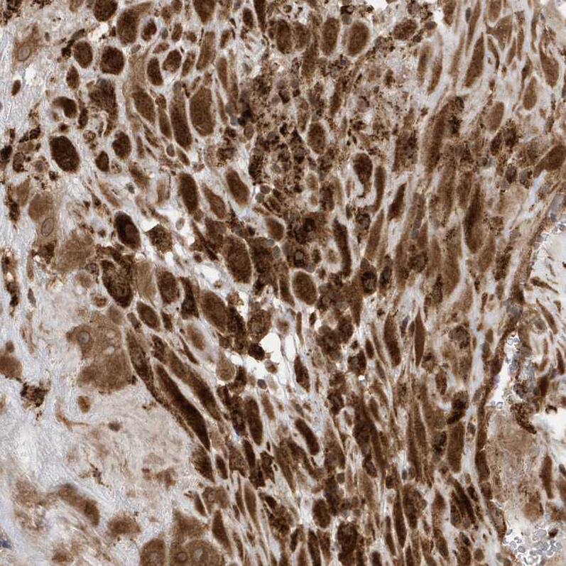 DHX36 Antibody - BSA Free Immunohistochemistry-Paraffin: DHX36 Antibody - BSA Free [NBP1-84286]