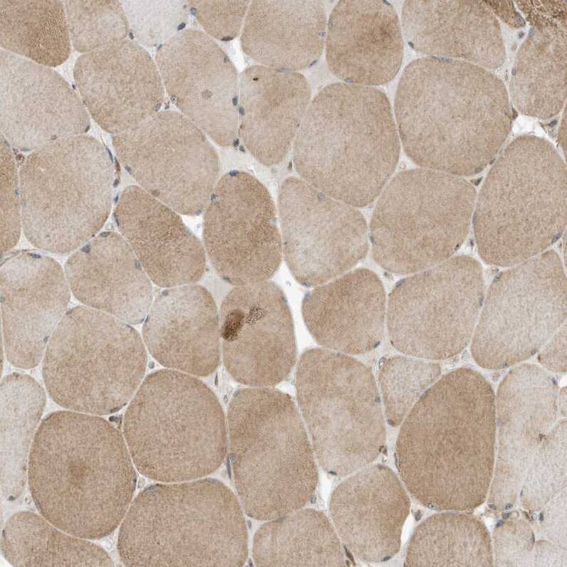 DHX36 Antibody - BSA Free Immunohistochemistry-Paraffin: DHX36 Antibody - BSA Free [NBP1-84286]