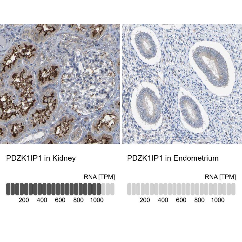 Map17 Antibody - BSA Free Immunohistochemistry-Paraffin: Map17 Antibody - BSA Free [NBP1-84290]